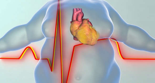 ما العلاقة بين الإصابة بقصور القلب وزيادة الوزن؟.. اعرف الحقيقة