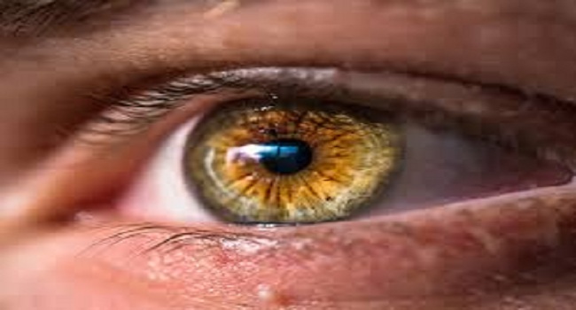 السكتة الدماغية فى العين أكثر شيوعًا بين كبار السن.. العلاج والوقاية